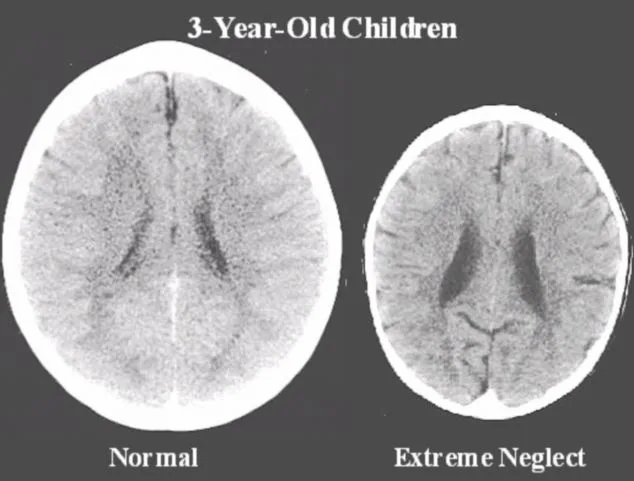 3-Year-Old-Children